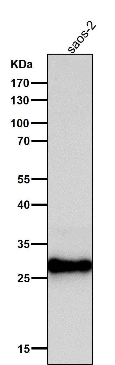All lanes use the Antibody at 1:1K dilution for 1 hour at room temperature