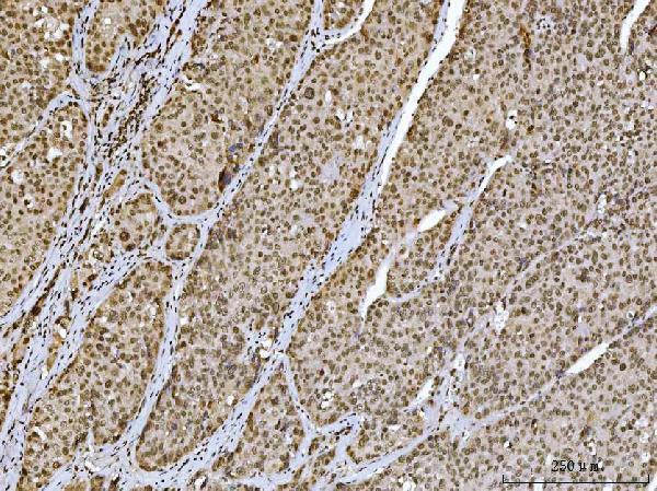  IHC analysis of Ataxin 1 using anti-Ataxin 1 antibody (M01786-1)