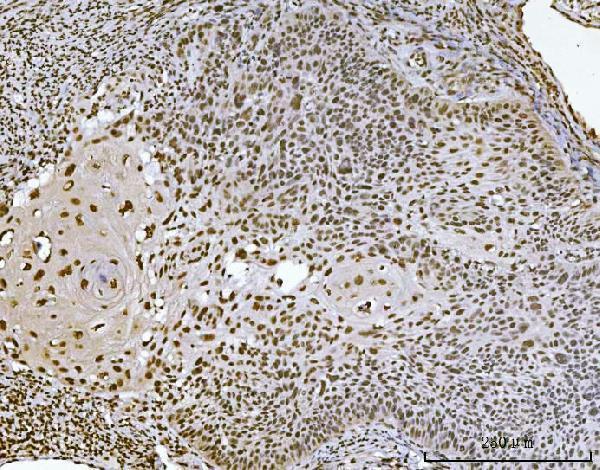  IHC analysis of Ataxin 1 using anti-Ataxin 1 antibody (M01786-1)
