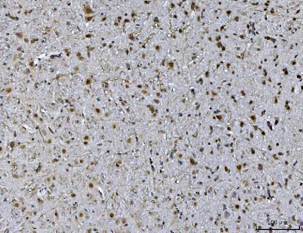 m01786 1 atxn1 primary antibodies ihc testing 5