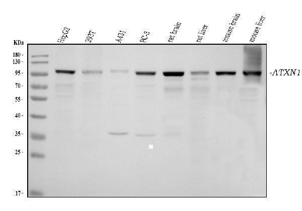  Western blot analysis of Ataxin 1 using anti-Ataxin 1 antibody (M01786-1)