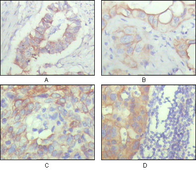 Immunohistochemistry validation of ALCAM using Anti-CD166 ALCAM Monoclonal Antibody (M01788-1)