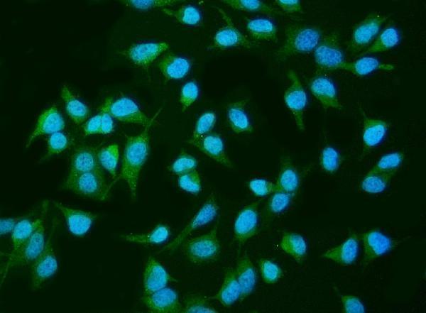 m01790 inpll1 primary antibodies if testing 7