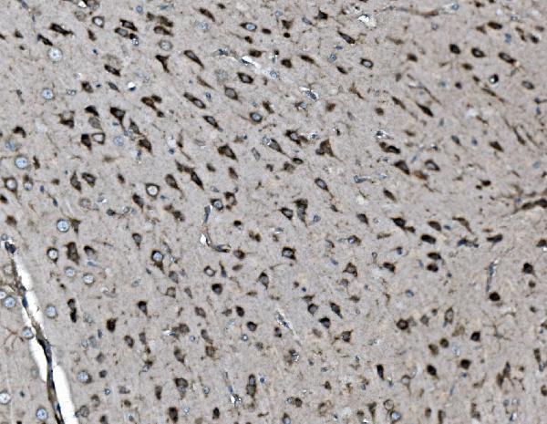 m01790 inpll1 primary antibodies ihc testing 2
