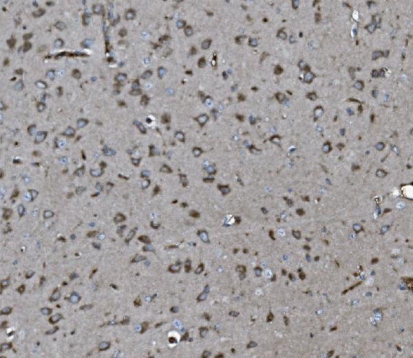 m01790 inpll1 primary antibodies ihc testing 3