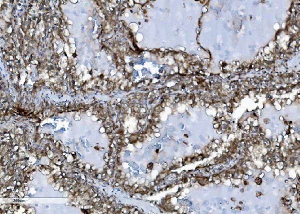 m01790 inpll1 primary antibodies ihc testing 5