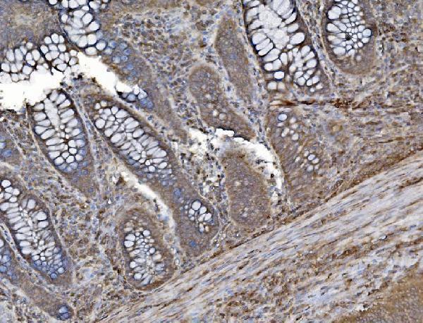 m01790 inpll1 primary antibodies ihc testing 6