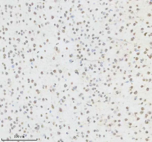IHC analysis of HNRNPK using anti-HNRNPK antibody (M01793)