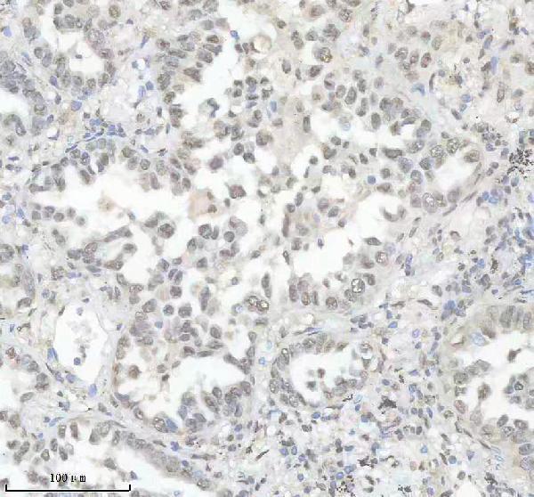 m01793 hnrnpk primary antibodies ihc testing 10