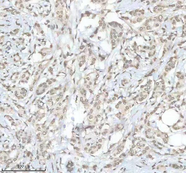 m01793 hnrnpk primary antibodies ihc testing 11