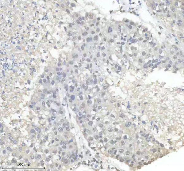 m01793 hnrnpk primary antibodies ihc testing 12