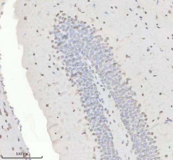IHC analysis of HNRNPK using anti-HNRNPK antibody (M01793)