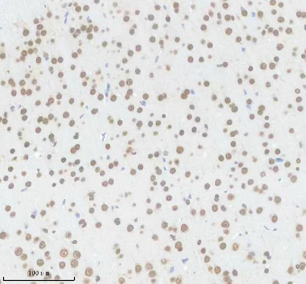 m01793 hnrnpk primary antibodies ihc testing 3