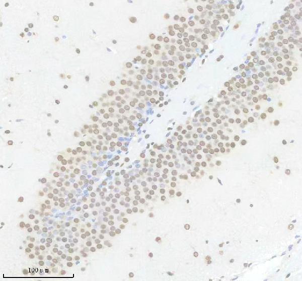 m01793 hnrnpk primary antibodies ihc testing 4
