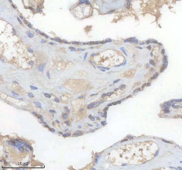 m01793 hnrnpk primary antibodies ihc testing 5