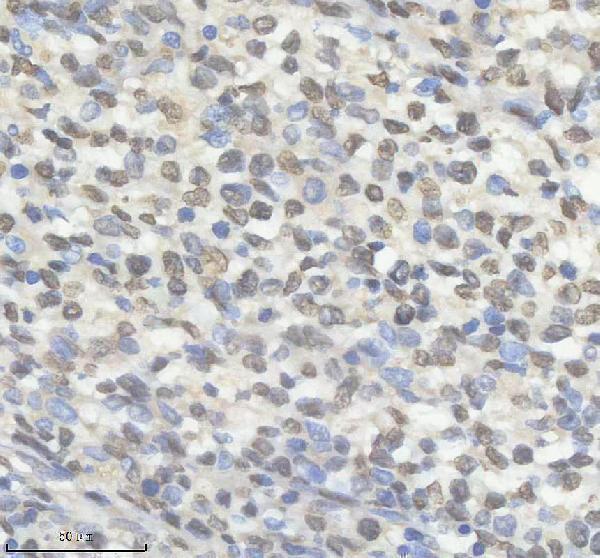 m01793 hnrnpk primary antibodies ihc testing 6
