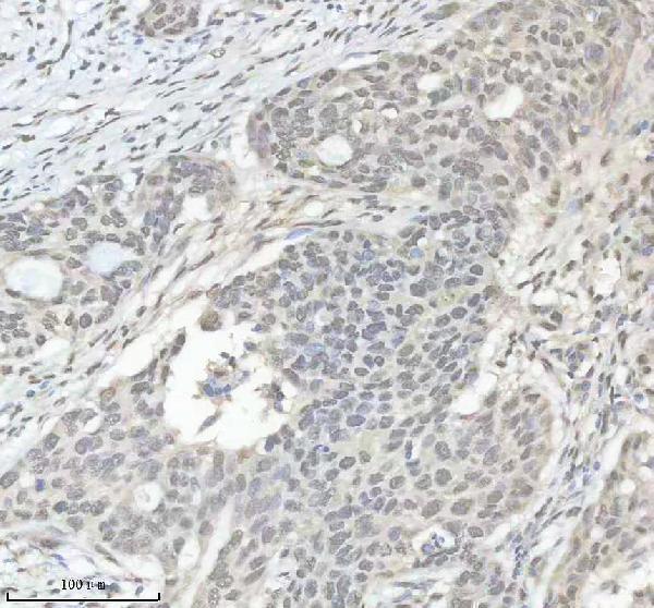 m01793 hnrnpk primary antibodies ihc testing 7