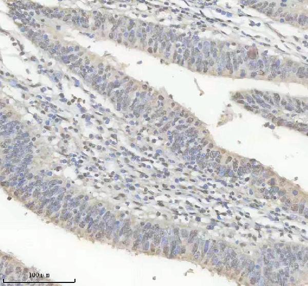 m01793 hnrnpk primary antibodies ihc testing 8