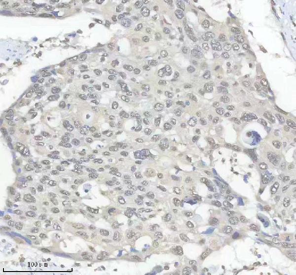 m01793 hnrnpk primary antibodies ihc testing 9