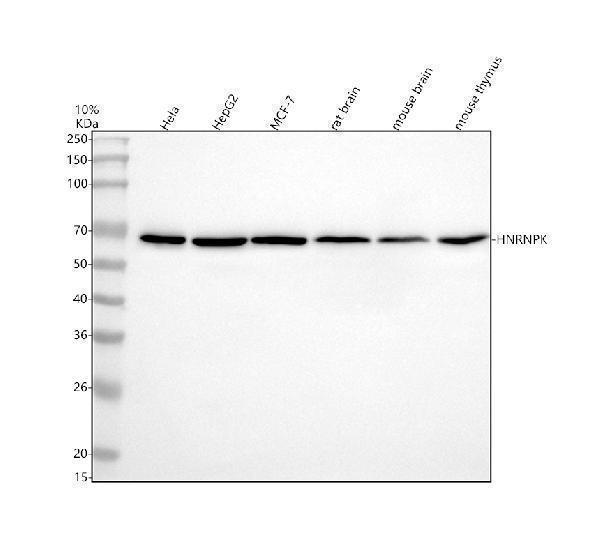 Western blot analysis of HNRNPK using anti-HNRNPK antibody (M01793)