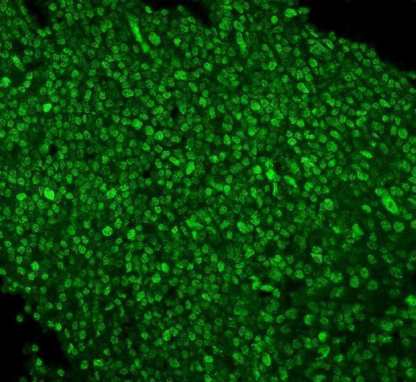 m01798 1 ptbp1 primary antibodies if testing 5
