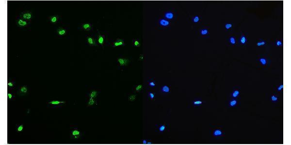 m01798 1 ptbp1 primary antibodies if testing 7