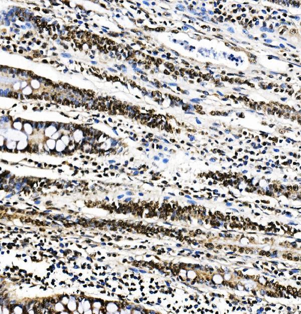 m01798 1 ptbp1 primary antibodies ihc testing 2