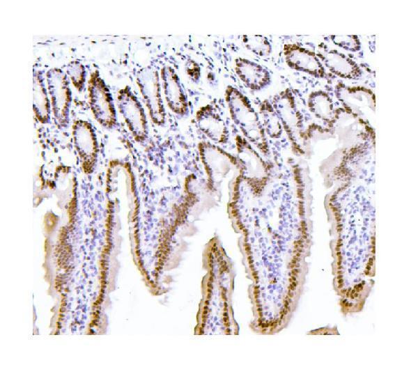 m01798 1 ptbp1 primary antibodies ihc testing 3