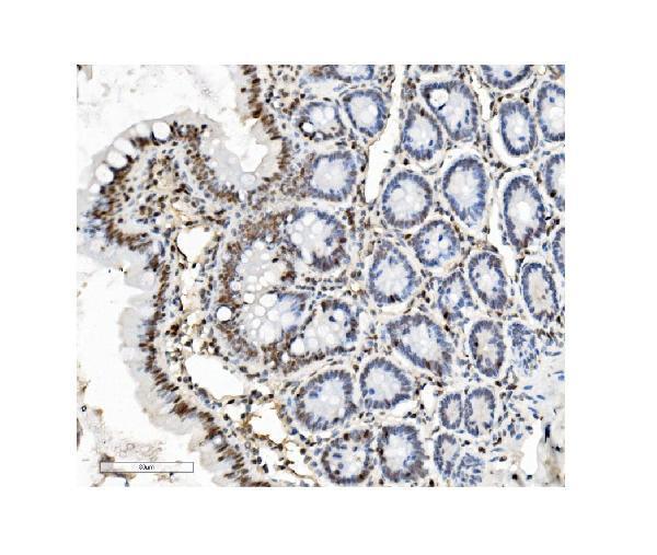 m01798 1 ptbp1 primary antibodies ihc testing 4