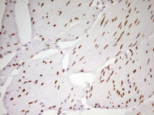 m01799 anti mef2d mouse monoclonal antibody clone id oti1e11 ihc testing 10