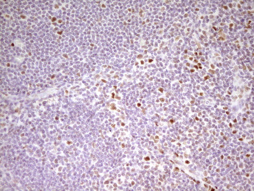 m01799 anti mef2d mouse monoclonal antibody clone id oti1e11 ihc testing 11