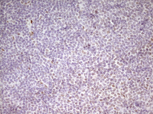 m01799 anti mef2d mouse monoclonal antibody clone id oti1e11 ihc testing 12