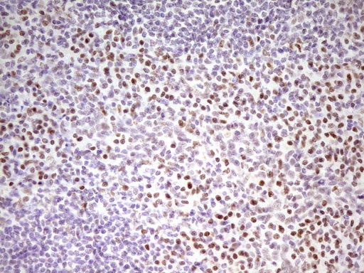 m01799 anti mef2d mouse monoclonal antibody clone id oti1e11 ihc testing 13