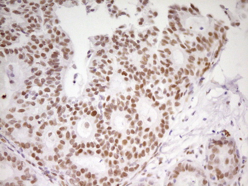 m01799 anti mef2d mouse monoclonal antibody clone id oti1e11 ihc testing 14