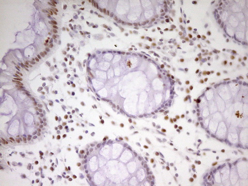 m01799 anti mef2d mouse monoclonal antibody clone id oti1e11 ihc testing 15