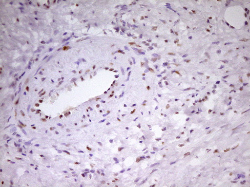 Immunohistochemical staining of paraffin-embedded Human Ovary tissue within the normal limits using anti-MEF2D mouse monoclonal antibody