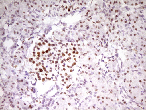 m01799 anti mef2d mouse monoclonal antibody clone id oti1e11 ihc testing 4