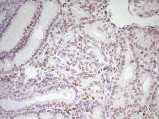 m01799 anti mef2d mouse monoclonal antibody clone id oti1e11 ihc testing 5