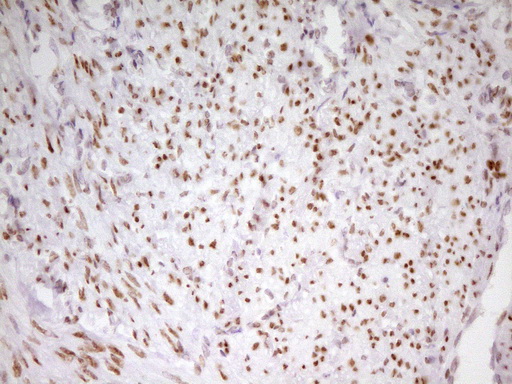 m01799 anti mef2d mouse monoclonal antibody clone id oti1e11 ihc testing 6