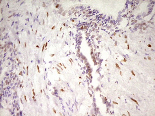 m01799 anti mef2d mouse monoclonal antibody clone id oti1e11 ihc testing 7