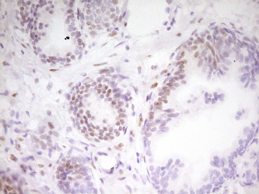 m01799 anti mef2d mouse monoclonal antibody clone id oti1e11 ihc testing 8