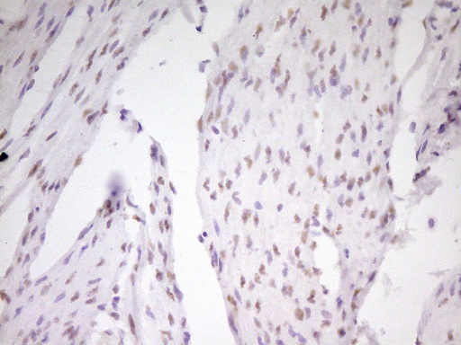 m01799 anti mef2d mouse monoclonal antibody clone id oti1e11 ihc testing 9