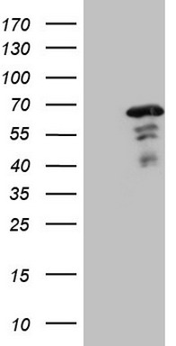 HEK293T cells were transfected with the pCMV6-ENTRY control (Left lane) or pCMV6-ENTRY MEF2D (Right lane) cDNA for 48 hrs and lysed