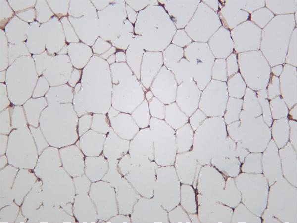 Rat white adipose was stained with anti-ATGL rabbit antibody