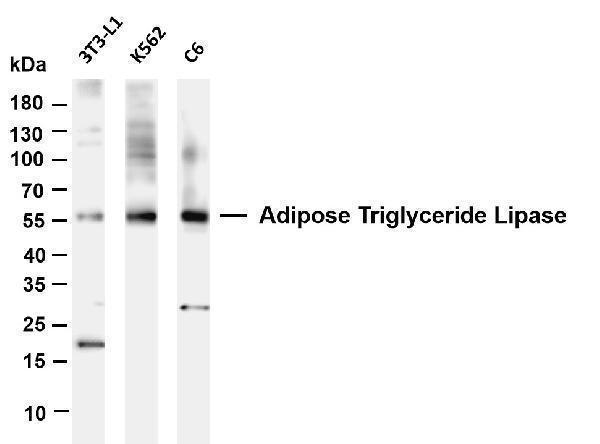 Various whole cell lysates were separated by 4-20% SDS-PAGE, and the membrane was blotted with anti- ATGL antibody