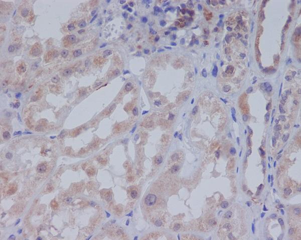 Immunohistochemical analysis of paraffin-embedded human kidney, using Acetyl-CoA Carboxylase Antibody
