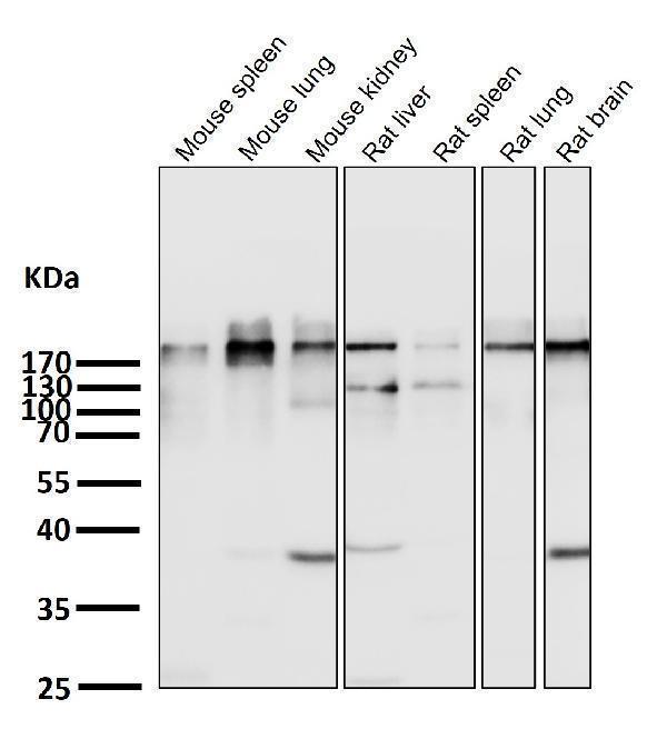 All lanes use the Antibody at 1:1K dilution for 1 hour at room temperature