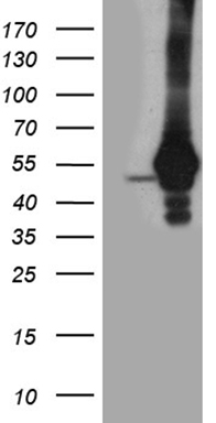 HEK293T cells were transfected with the pCMV6-ENTRY control (Left lane) or pCMV6-ENTRY TDP2 (Right lane) cDNA for 48 hrs and lysed