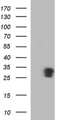 HEK293T cells were transfected with the pCMV6-ENTRY control (Left lane) or pCMV6-ENTRY GADD45A (Right lane) cDNA for 48 hrs and lysed
