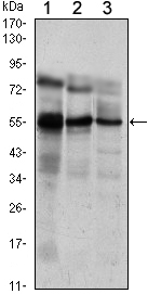 Western Blot analysis using ERM Monoclonal Antibody against Jurkat (1), NIH/3T3 (2) and MCF-7 (3) cell lysate